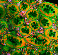 Coupe d’intestin de singe vert infecté par le SIV montrant des cellules « NK »