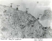 Virus VIH-1 au bord d'un lymphocyte T4.