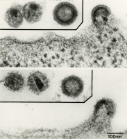 Virus VHI-1 et virus VIH-2.