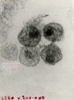 Virus VIH-1. Photo de 1985.