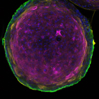 Section transversale d'un organode de peau généré à partir de kératinocytes humains