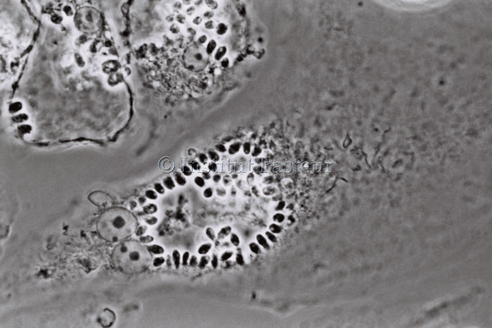 Macrophages de souris hébergeant des amastigotes de Leishmania mexicana