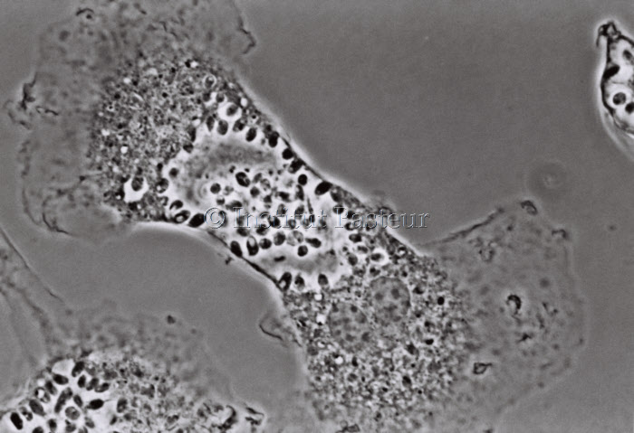Macrophages de souris hébergeant des amastigotes de Leishmania mexicana
