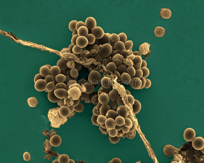 Bactéries Staphylococcus aureus (staphylocoque doré). Microscopie électronique à balayage. Image colorisée.