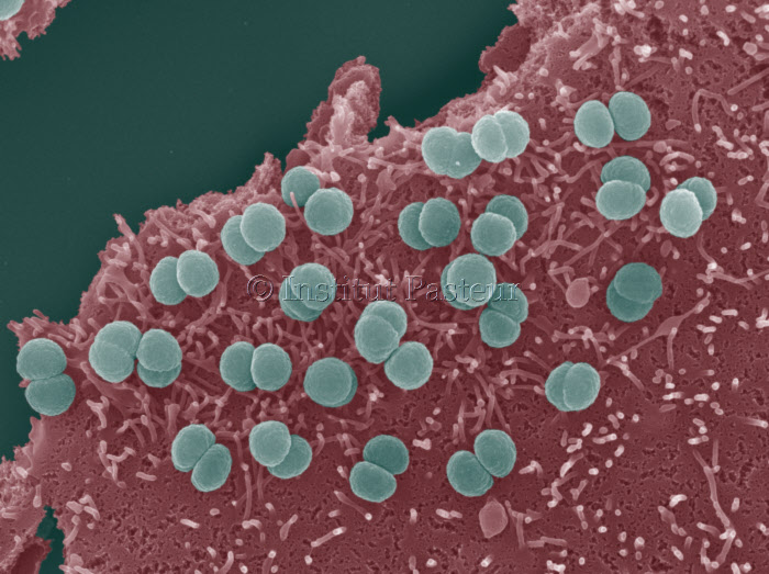 Neisseria meningitidis adhérant à la surface de cellules épithéliales