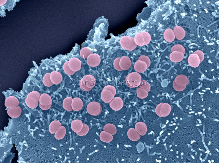 Neisseria meningitidis (méningocoques) adhérant à la surface de cellules épithéliales. Microscopie électronique à balayage.