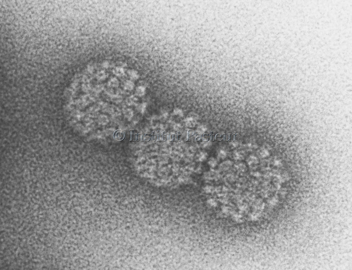 Particules de papillomavirus type HPV-1