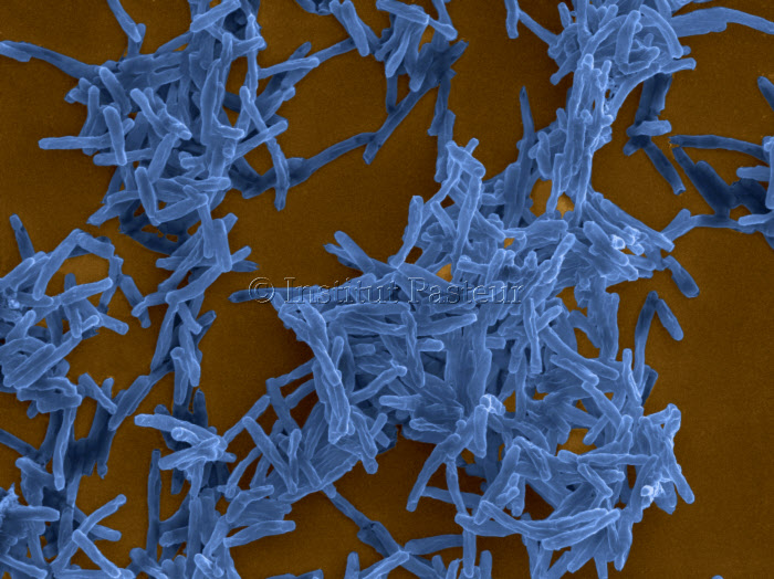 Mycobacterium tuberculosis, agent de la tuberculose. Microscopie electronique à balayage colorisée.