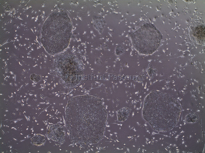 Cellules iPS