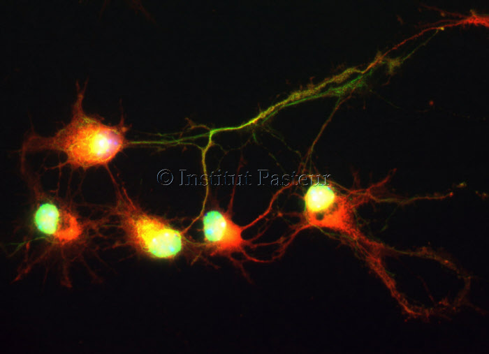 Neurones mis en culture pendant 4 jours sur une surface homogène cytophile