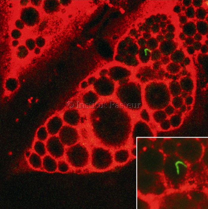 Visualisation en microscopie confocale du bacille de la tuberculose (en vert) dans un adipocyte humain