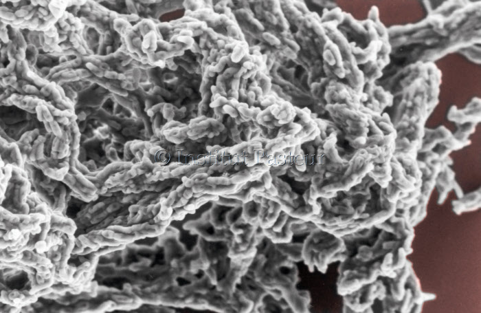 Mycobacterium cheloniae en microscopie electronique à balayage. Fausses couleurs.