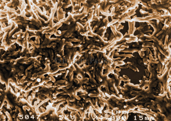Mycobacterium kansaii en microscopie electronique à balayage. Fausses couleurs.