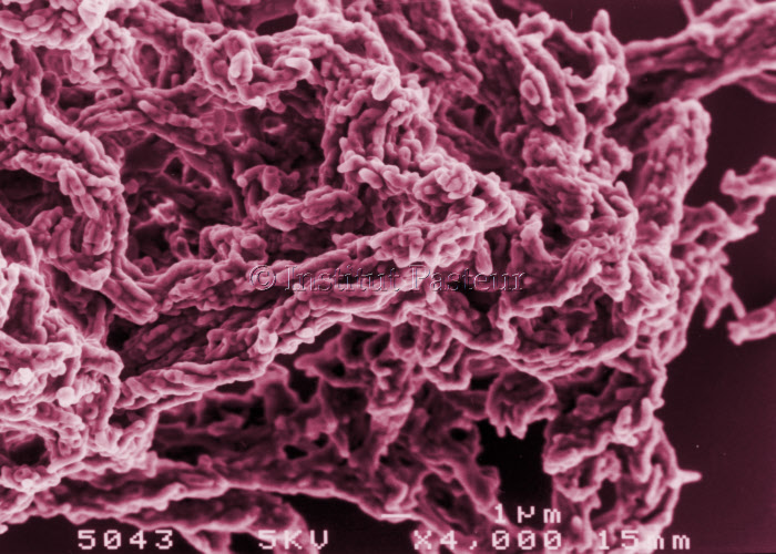 Mycobacterium chelonae en microscopie electronique à balayage. Fausses couleurs.