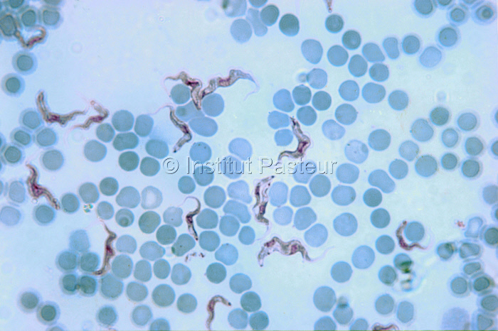 Trypanosoma brucei gambiense dans le sang humain