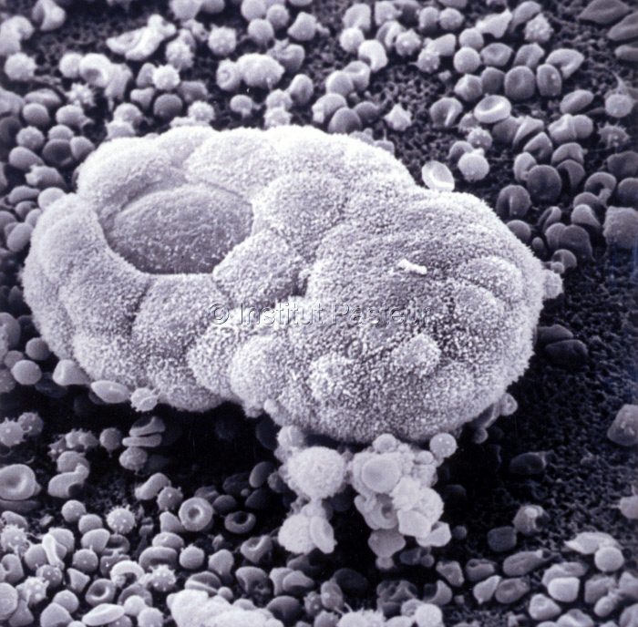 Tératocarcinome utilisé comme modèle de développement embryonnaire de la souris
