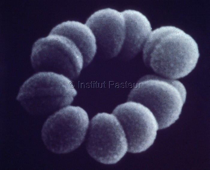 Streptococcus sp