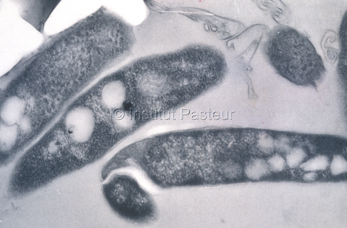 Mycobacterium bovis ou bacille de Calmette et Guérin (BCG)