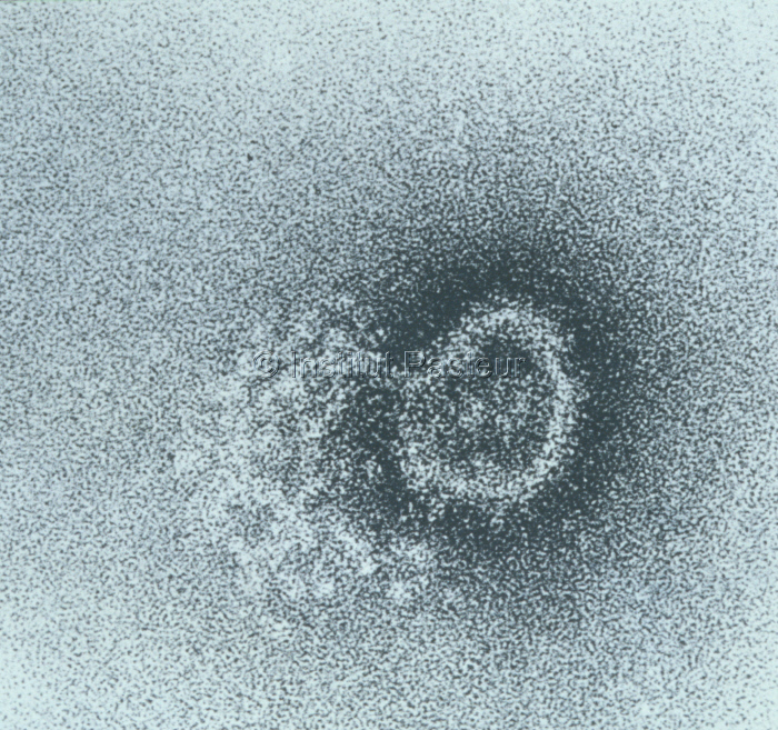 Virus Lumbo