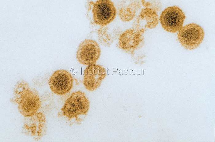 Virus de la fièvre de la Vallée du Rift (famille des Bunyaviridae)