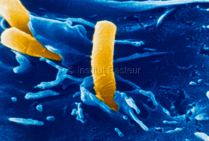Phagocytose de trois bactéries par un macrophage. Image colorisée.