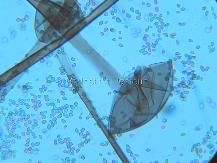  Rhizopus oryzae. Sporocystes et sporocystospores. Montage au bleu lactique.