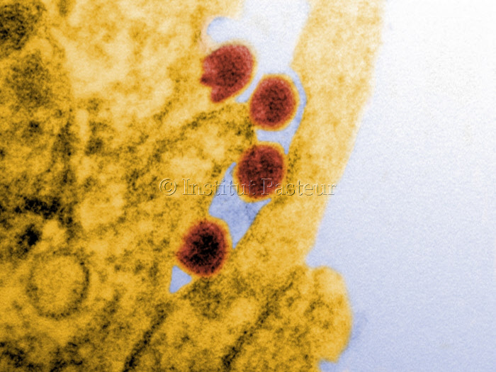 Virus Chikungunya (en rouge) bourgeonnant à la surface de cellules épithéliales humaines