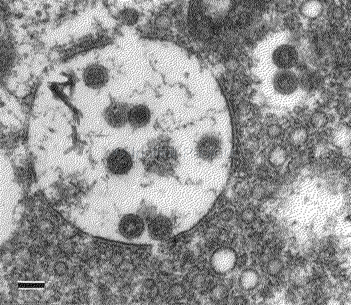 Bourgeonnement de particules virales du virus de la fièvre de la Vallée du Rift dans l'appareil de Golgi d'une cellule infectée