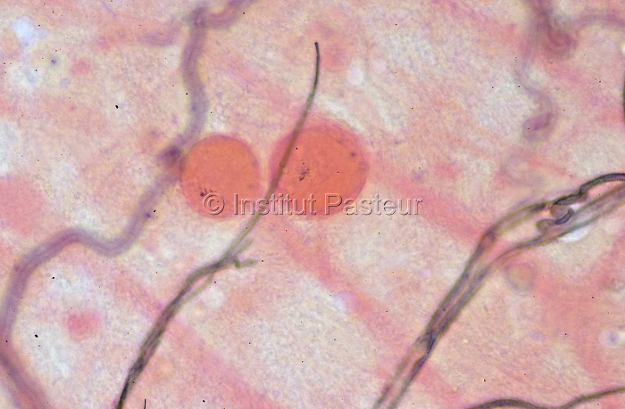 Tube digestif d'Anopheles gambiae parasité par Plasmodium falciparum