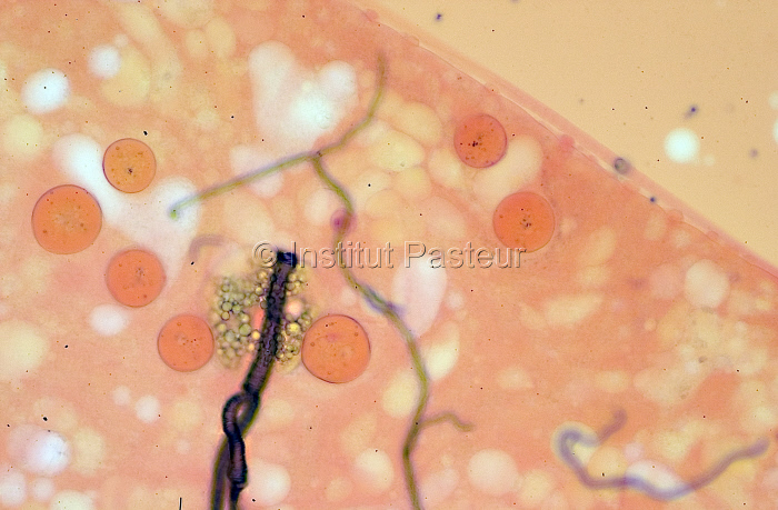 Tube digestif d'Anopheles gambiae parasité par Plasmodium falciparum