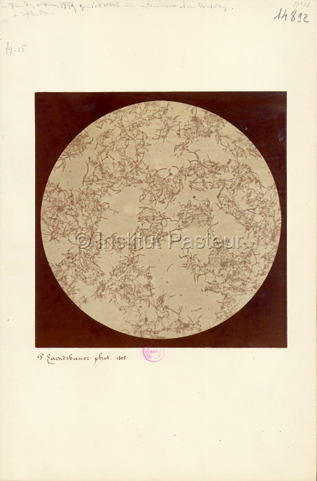 Microphotographie montrant des microbes observés par Pasteur