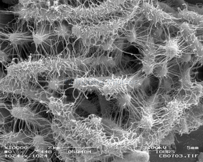 In vitro biofilm dans une chambre implantable d'une souche uropathogène d'Escherichia coli (536).