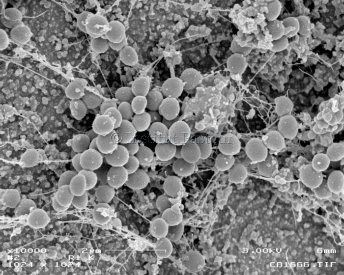 Biofilm in vivo dans une chambre implantable d'une souche de Staphylococcus aureus