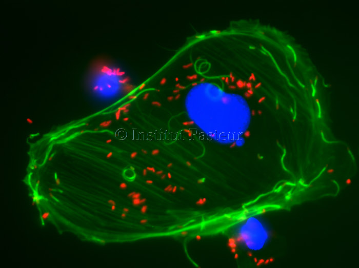 Observation en microscopie à fluorescence d'une cellules infectée par Listeria.