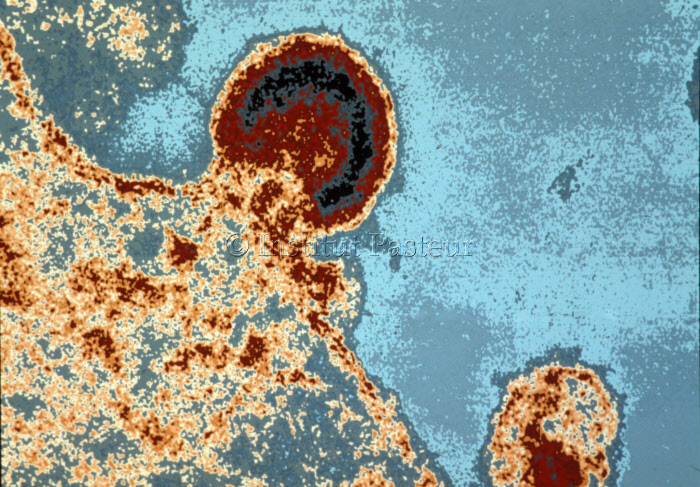 Bourgeonnement de virus VIH-1 à la surface d'un lymphocyte