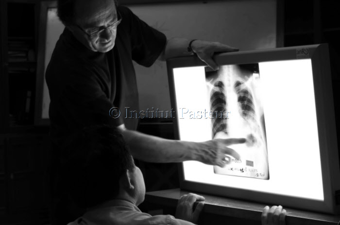 Etude d'une radiographie - Atelier de formation de radiologues Cambodgiens
