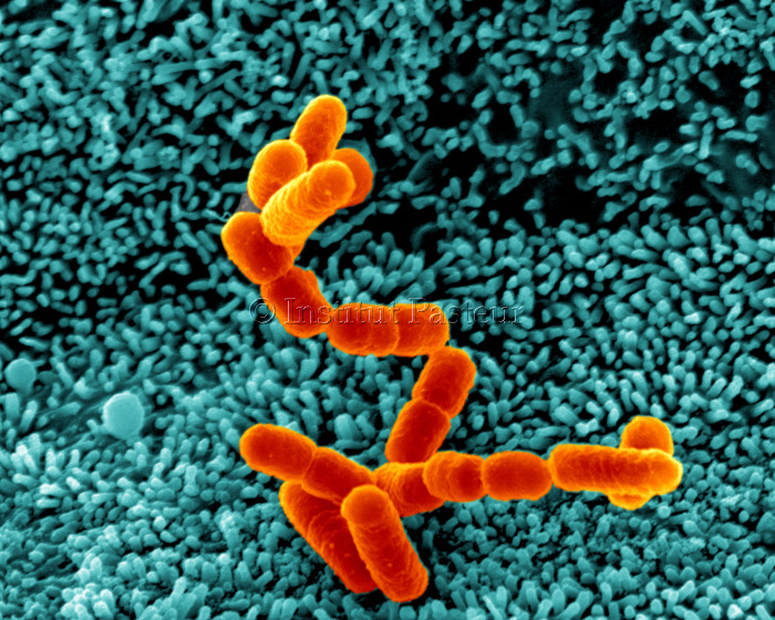 Bactéries Escherichia coli en interaction avec des cellules de l'épithélium intestinal humain. Microscopie électronique à balayage. Image colorisée.