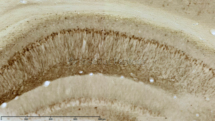 Dégénérescences (ou enchevêtrements) neurofibrillaires chez la souris