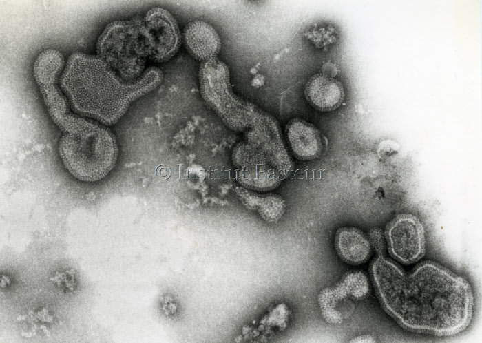 Virus de la grippe (Influenza) A/TEXAS/1/77 (H3N2)