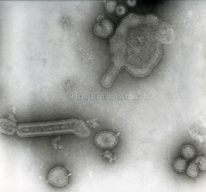 Virus de la grippe A/TeXAS/1/77 (H3N2)