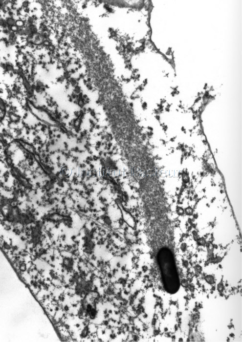 Bactérie Listeria se propulsant dans la cellule infectée