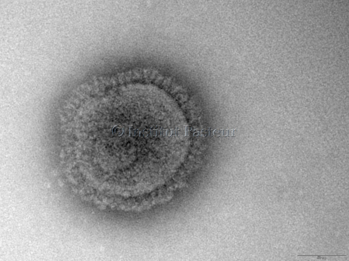 Microphotographie du virus de la grippe A.