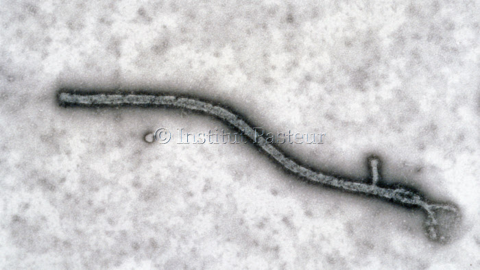 Virus Ebola en microscopie électronique à transmission
