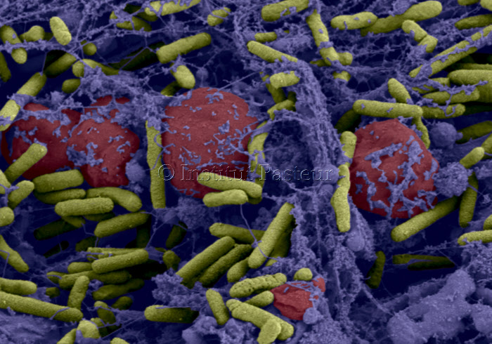 Biofilm de bactéries Pseudomonas aeruginosa formé dans un catheter central.
