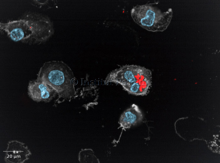 Legionella pneumophila strain Paris replicating within human macrophages.
