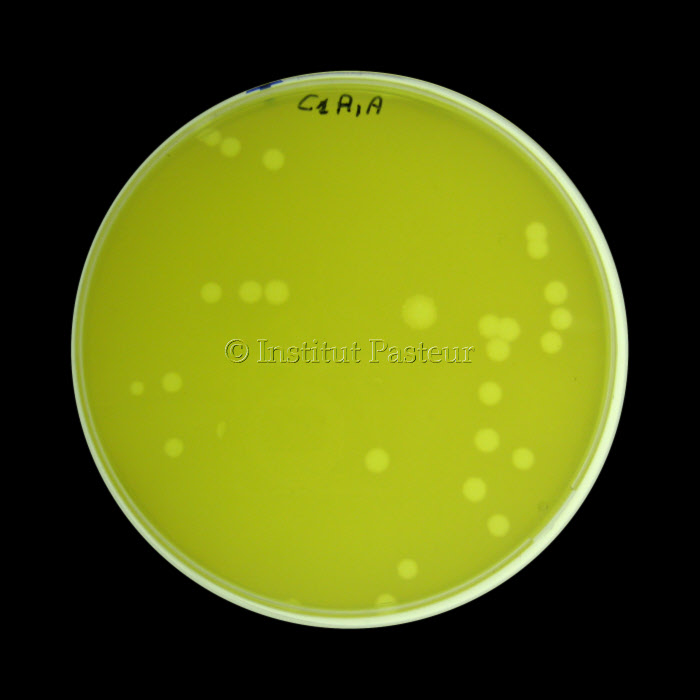 Plages de lyse d'un bactériophage virulent infectant une souche de Pseudomonas aeruginosa 