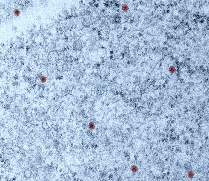 Cellules infectées par le virus du Zika en microscopie électronique à transmission