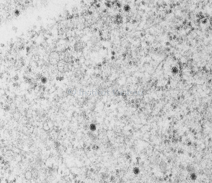 Cellules de singe vert infectées par le virus du Zika en microscopie électronique à transmission