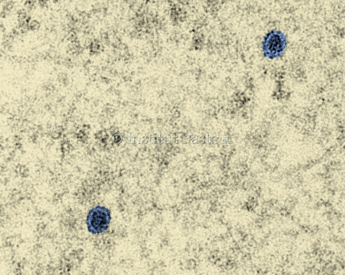Cellules infectées par le virus du Zika en microscopie électronique à transmission.