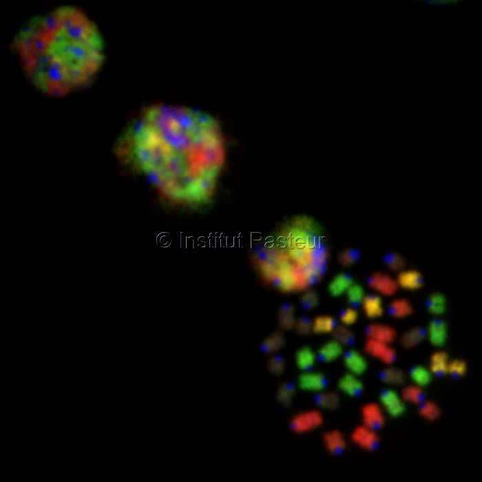 Chromosomes métaphasiques et noyaux interphasiques de cellules pre-B